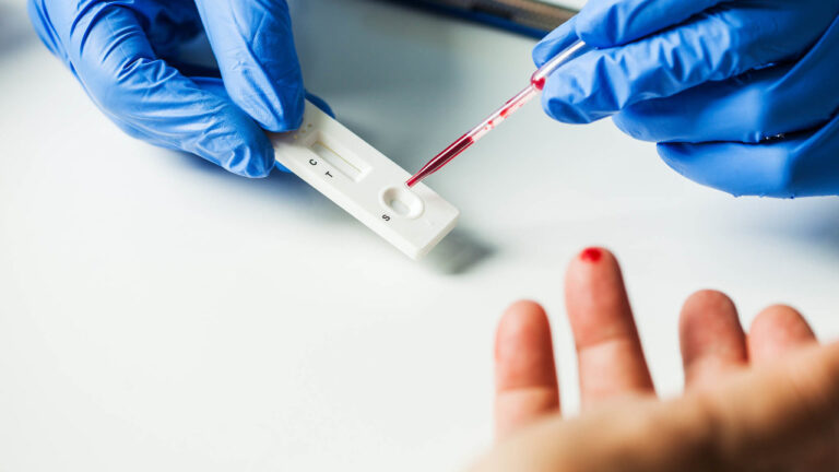 EK se chystá doporučit zemím využívání covidových rychlotestů