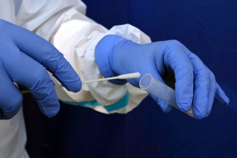 SZÚ: Omikron tvoří 95 procent všech případů koronaviru, BA.2 procento