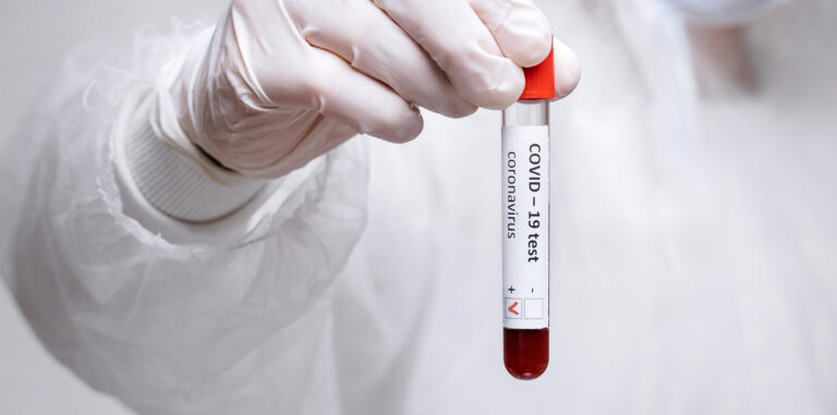 Počty nově nakažených v mezitýdenním srovnání dál klesají, ve středu přibylo 195