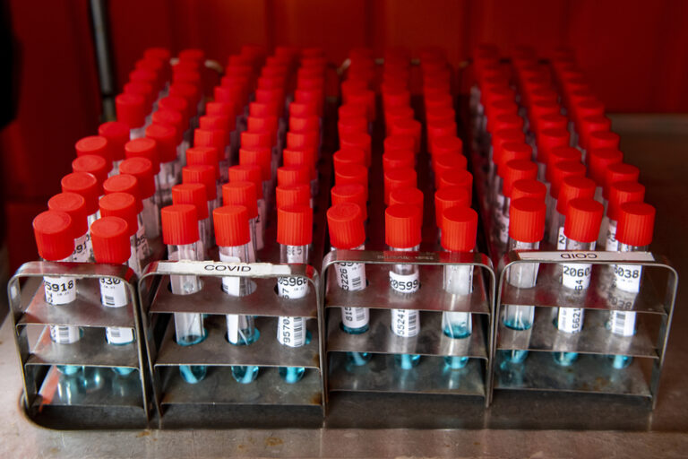 Koronaviru začalo opět přibývat, nárůst je podobný jako loni